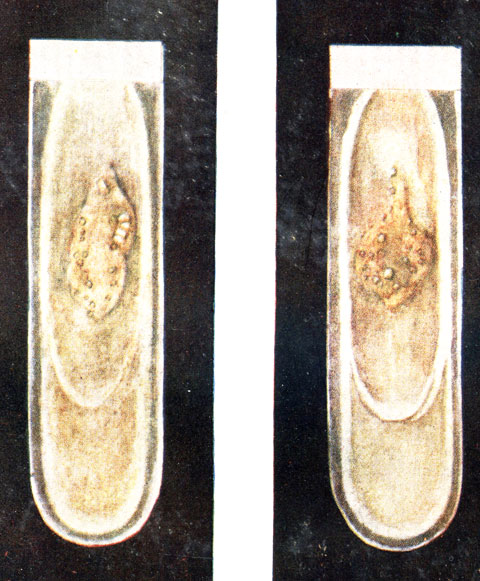  8.   Histoplasma farciminosum.  ,      .         28-30 .  .  . 