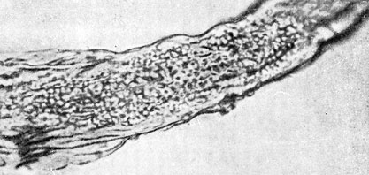  42.  ,  Microsporum lanosum.       . X 400. 