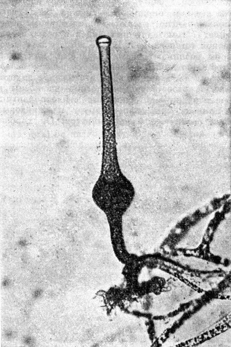 . 37.   (Saksenaea vasiformis)