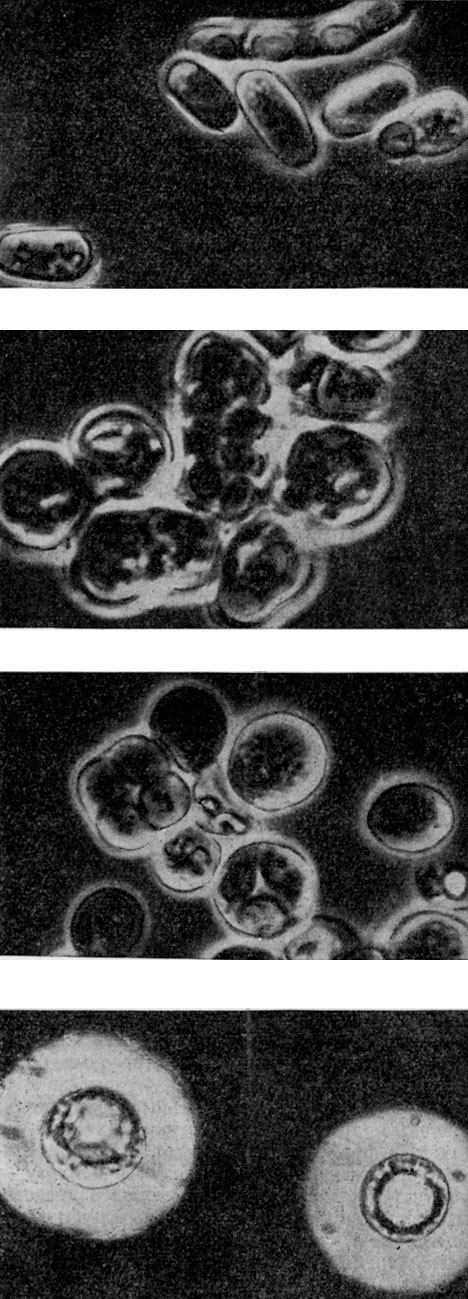 . 60.   ( ): Schizosaccharomyces pombe (      ); Schizosaccharomyces octosporus (      ); Saccharomyces cerevisiae (     ); Lipomyces starkeyi ()