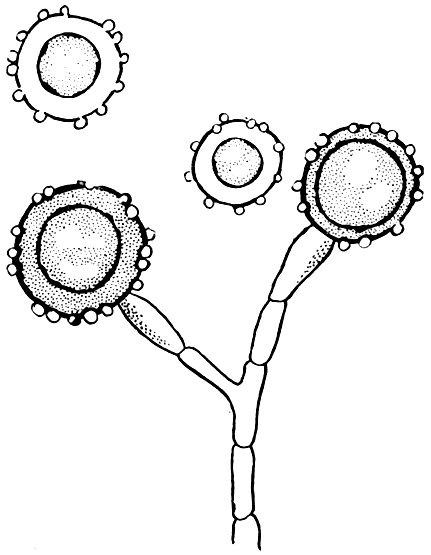 . 80.   (Histoplasma capsulatum). 
