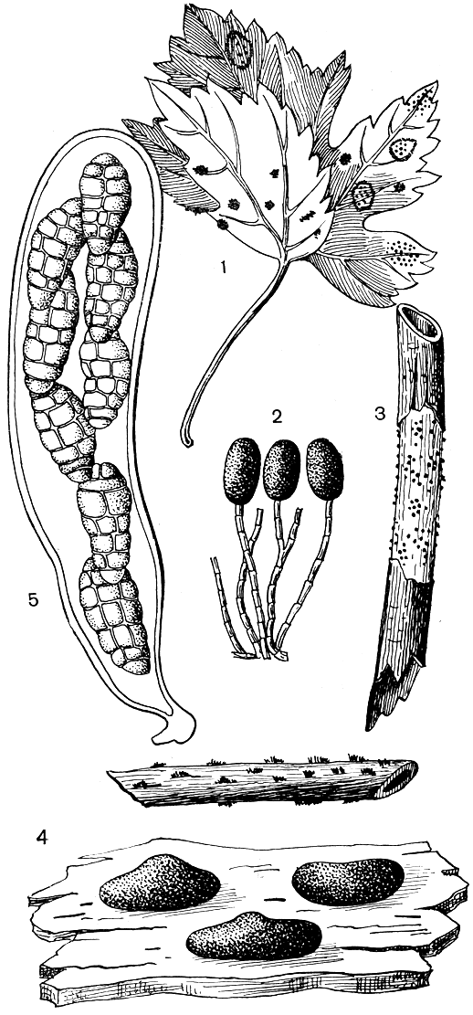 . 144.   (Pleospora herbarum): 1 -   ,     ; 2 -    ; 3 -          ; 4 - ; 5 -   